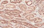CPT1A Antibody in Immunohistochemistry (Paraffin) (IHC (P))