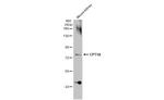 CPT1A Antibody in Western Blot (WB)