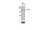 CPT1A Antibody in Western Blot (WB)