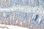 Cytokeratin 19 Antibody in Immunohistochemistry (Paraffin) (IHC (P))