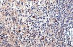 PARP14 Antibody in Immunohistochemistry (Paraffin) (IHC (P))