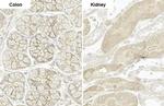 PARP14 Antibody in Immunohistochemistry (Paraffin) (IHC (P))