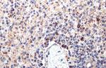 PARP14 Antibody in Immunohistochemistry (Paraffin) (IHC (P))