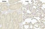 PARP14 Antibody in Immunohistochemistry (Paraffin) (IHC (P))