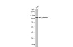 Artemis Antibody in Western Blot (WB)