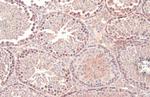 Dicer Antibody in Immunohistochemistry (Paraffin) (IHC (P))