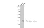 Thymidylate Synthase Antibody in Western Blot (WB)