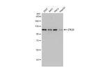 CYLD Antibody in Western Blot (WB)