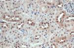 ITK Antibody in Immunohistochemistry (Paraffin) (IHC (P))
