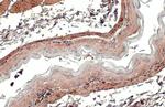 TAGLN Antibody in Immunohistochemistry (Paraffin) (IHC (P))