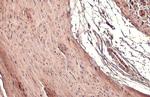 TAGLN Antibody in Immunohistochemistry (Paraffin) (IHC (P))