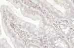 TAGLN Antibody in Immunohistochemistry (Paraffin) (IHC (P))