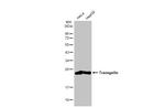 TAGLN Antibody in Western Blot (WB)