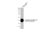 RSV Type A NP Antibody in Western Blot (WB)