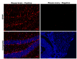 GFAP Antibody in Immunohistochemistry (Paraffin) (IHC (P))