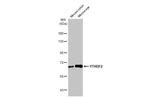 YTHDF2 Antibody in Western Blot (WB)