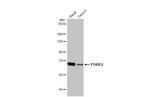 YTHDF2 Antibody in Western Blot (WB)