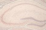 YTHDF2 Antibody in Immunohistochemistry (Paraffin) (IHC (P))