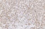 PARP1 Antibody in Immunohistochemistry (Paraffin) (IHC (P))
