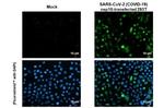 SARS-CoV-2 NSP10 Recombinant Rabbit Monoclonal Antibody (HL1379)
