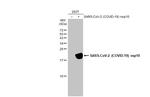 SARS-CoV-2 NSP10 Antibody in Western Blot (WB)