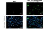 Lassa Virus Nucleoprotein Recombinant Rabbit Monoclonal Antibody (HL1392)