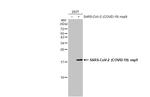SARS-CoV-2 NSP9 Antibody in Western Blot (WB)