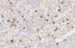 p53R2 Recombinant Rabbit Monoclonal Antibody (HL1400)