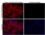 Carbonic Anhydrase IX Antibody in Immunohistochemistry (Paraffin) (IHC (P))