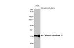 Carbonic Anhydrase IX Antibody in Western Blot (WB)