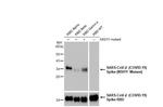 SARS-CoV-2 Spike (N501Y Mutant) Recombinant Rabbit Monoclonal Antibody (HL1425)