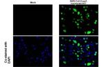 SARS-CoV-2 NSP1 Recombinant Rabbit Monoclonal Antibody (HL1435)