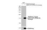 SARS-CoV-2 Envelope Antibody in Western Blot (WB)