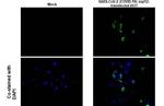 SARS-CoV-2 NSP12 Antibody in Immunocytochemistry (ICC/IF)