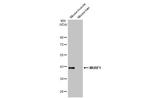 MURF1 Recombinant Rabbit Monoclonal Antibody (HL1450)