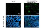 SARS-CoV-2 ORF7b Antibody in Immunocytochemistry (ICC/IF)