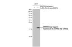 SARS-CoV-2 ORF7b Antibody in Western Blot (WB)