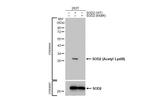 Acetyl-SOD2 (Lys68) Recombinant Rabbit Monoclonal Antibody (HL1460)
