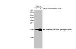 H3K18ac Antibody in Western Blot (WB)