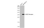 MC1R Recombinant Rabbit Monoclonal Antibody (HL1470)
