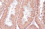 DDX4 Recombinant Rabbit Monoclonal Antibody (HL1487)