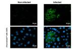 Chikungunya Virus NSP2 Antibody in Immunocytochemistry (ICC/IF)