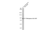 Chikungunya Virus NSP2 Antibody in Western Blot (WB)