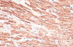 Cardiac Troponin I Antibody in Immunohistochemistry (Paraffin) (IHC (P))
