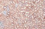 TOMM20 Antibody in Immunohistochemistry (Paraffin) (IHC (P))