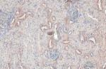 RAB5 Recombinant Rabbit Monoclonal Antibody (HL1497)