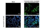 Venezuelan Equine Encephalitis Virus NSP3 Antibody in Immunocytochemistry (ICC/IF)