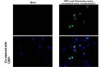 Venezuelan Equine Encephalitis Virus NSP3 Antibody in Immunocytochemistry (ICC/IF)