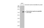 Venezuelan Equine Encephalitis Virus NSP3 Antibody in Western Blot (WB)