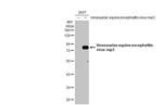 Venezuelan Equine Encephalitis Virus NSP3 Recombinant Rabbit Monoclonal Antibody (HL1504)